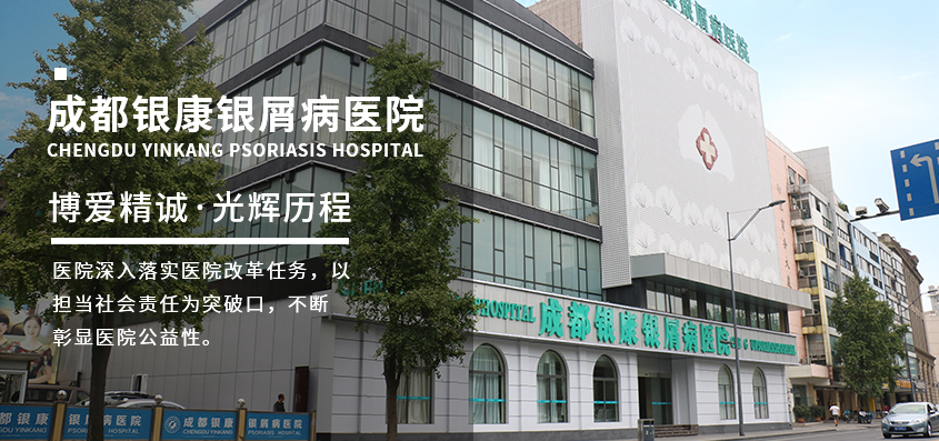 成都银康银屑病医院